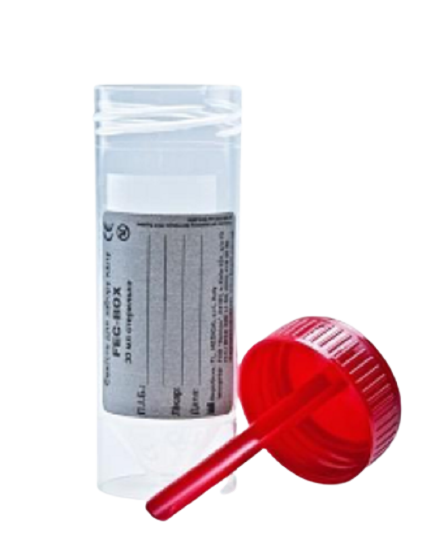 Контейнер для аналізу калу стерильний 30 мл